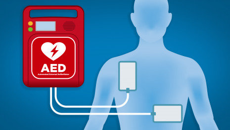 醫用護理床：黃金搶救4分鐘，使用CPR，AED指南！